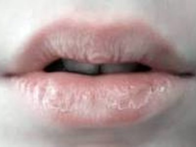 اگر این علائم را دارید از رژ لب استفاده نکنید
