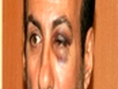 ضرب و شتم پزشک جراح در بیمارستان شهید بهشتی یاسوج