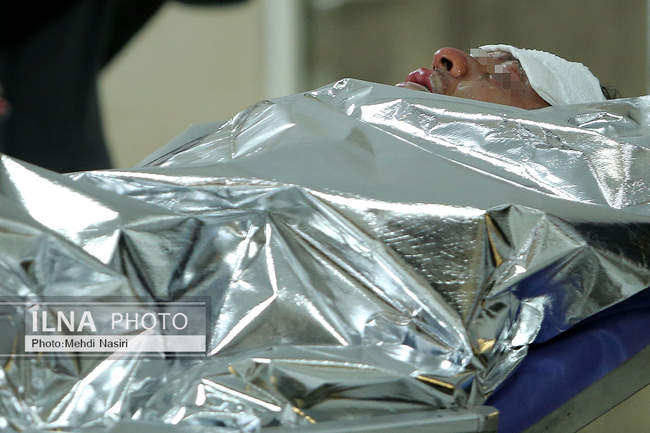 مصدومان چهارشنبه سوری بیمارستان سوانح سوختگی تهران