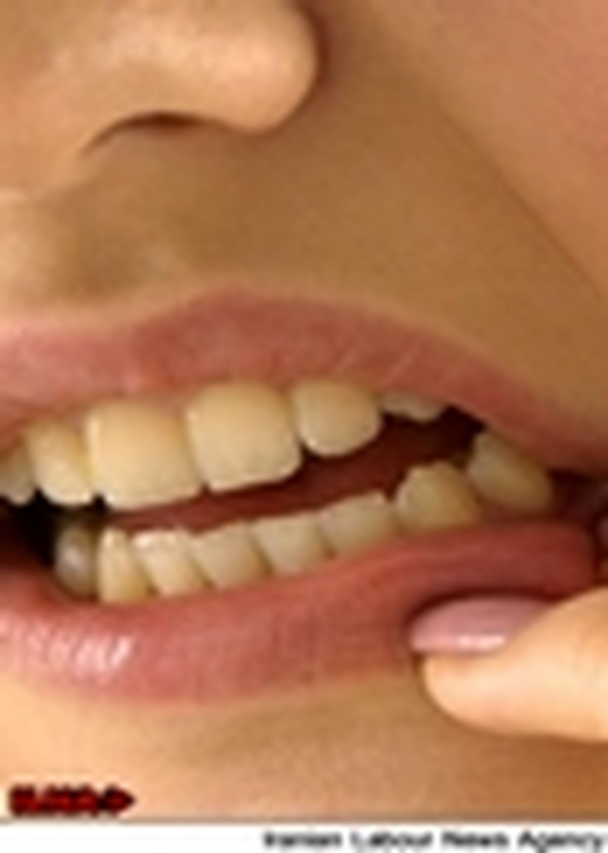 دندان قروچه از عوامل ایجاد دردهای مزمن در سر و صورت