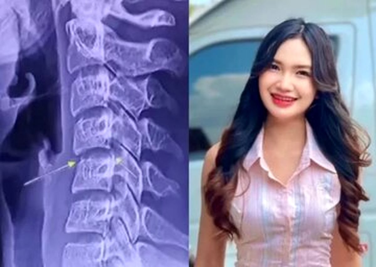 ماساژ گردن، خواننده تایلندی را به کشتن داد