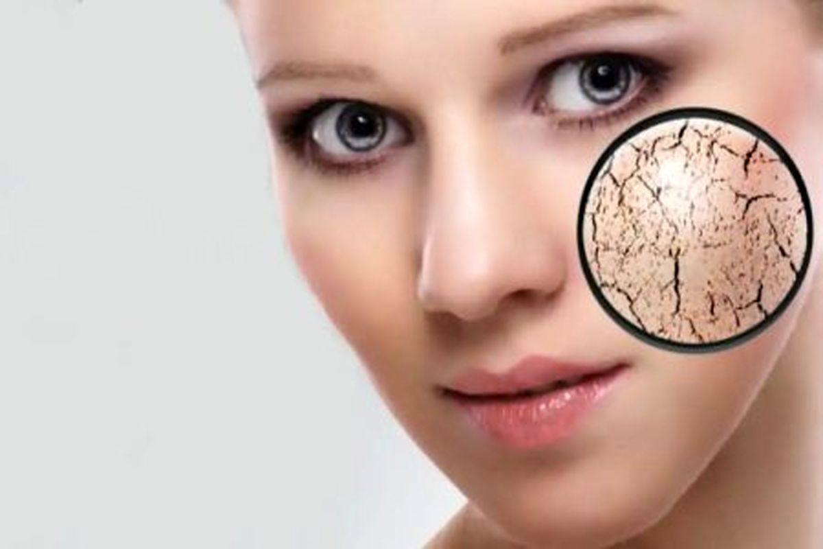 روش پاکسازی پوست خشک در منزل