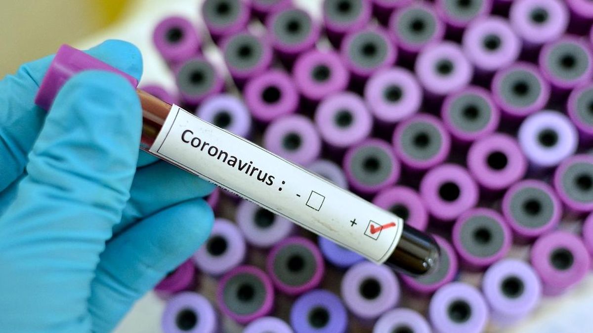 میزان مرگ و میر مبتلایان به کرونا در نیشابور بیشتر از دیگر شهرهای خراسان رضوی