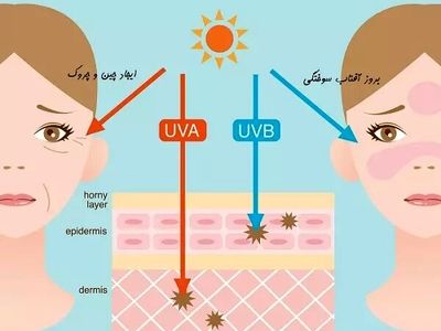 راه‌های پیشگیری از آسیب‌زایی اشعه UV بر پوست و مو/ توضیحات یک دکترای صلاحیت حرفه‌ای پوست و مو