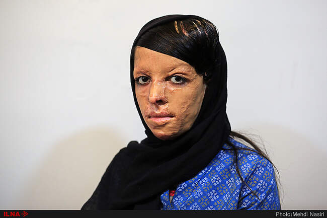 موج آرزوهای سوخته بر صورت دخترکان شین آبادی