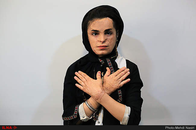 موج آرزوهای سوخته بر صورت دخترکان شین آبادی