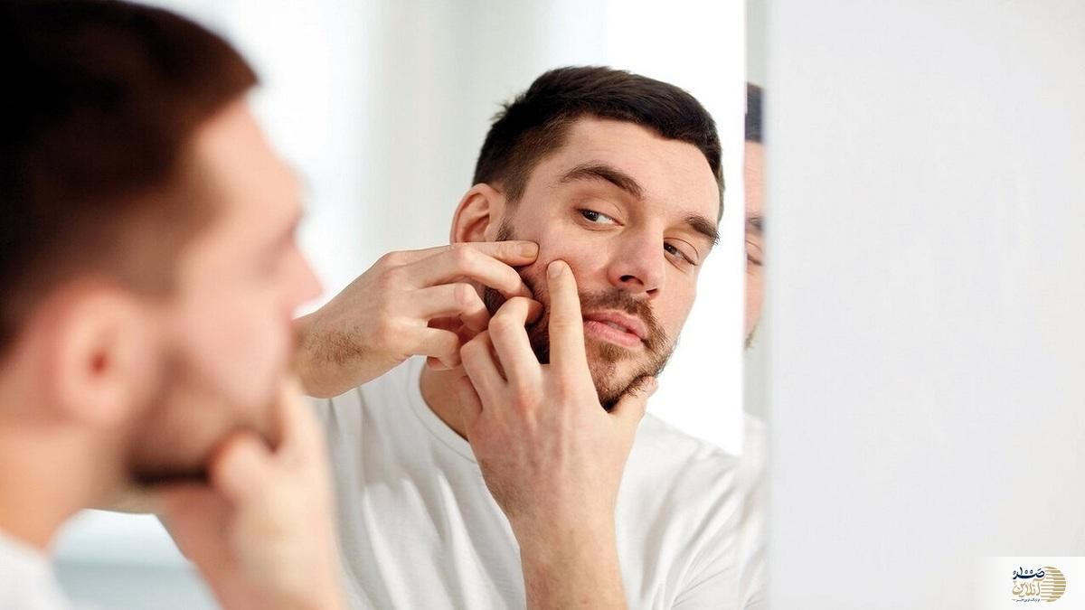 پنج ماده موثر برای پاکسازی پوست و نابودی آکنه 