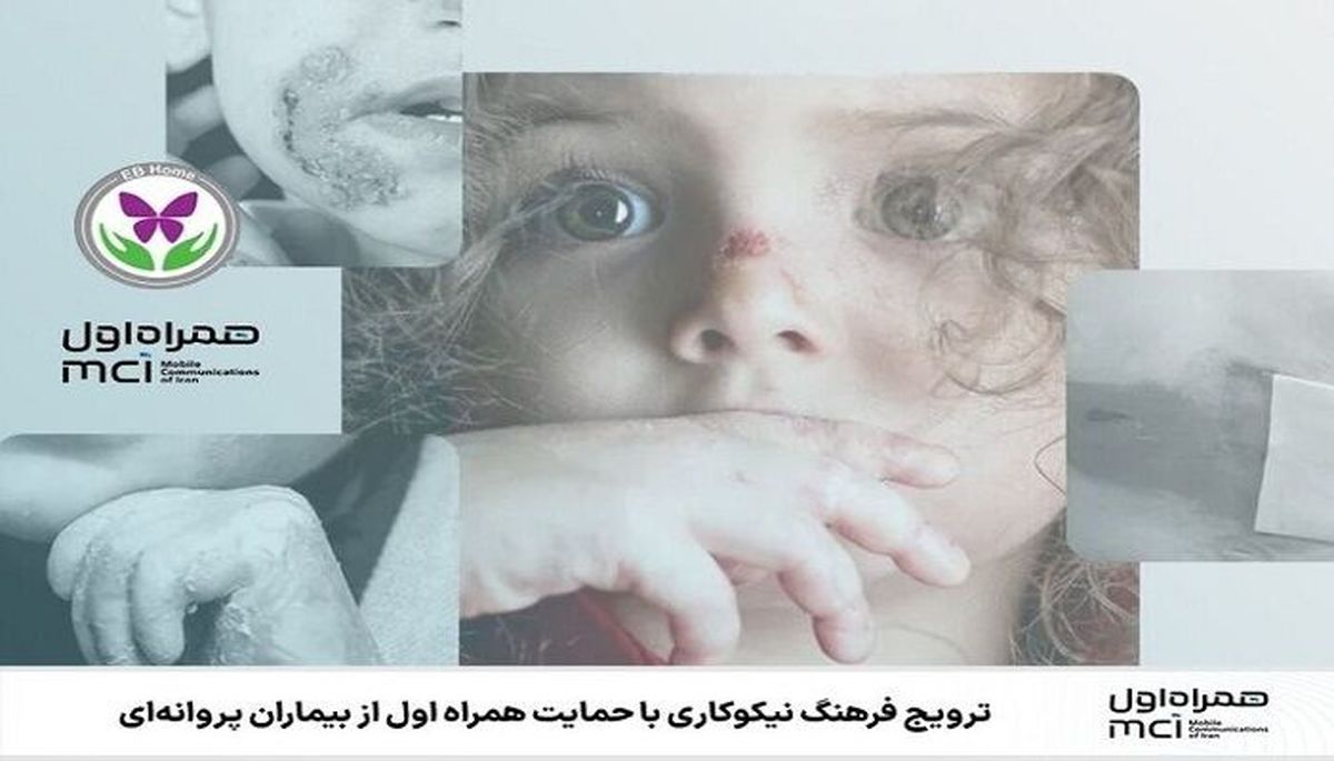 ترویج فرهنگ نیکوکاری با حمایت همراه اول از بیماران پروانه‌ای