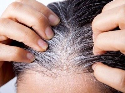 دلیل سفید شدن موها ، چرا مو سفید می شود.