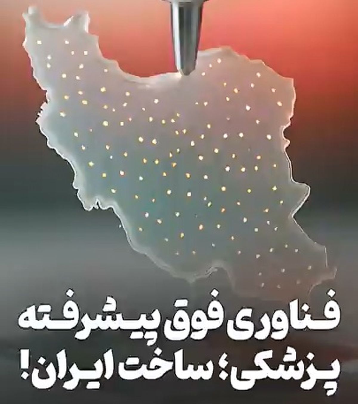 ورود ایران به باشگاه فناوری‌های فوق ‌پیشرفتۀ پزشکی در دنیا، این هم مدرکش! + فیلم