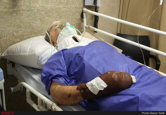 بازدید رئیس اورژانس کشور و معاون درمان وزیر بهداشت از مصدومان تصادف اتوبوس زائران اربعین