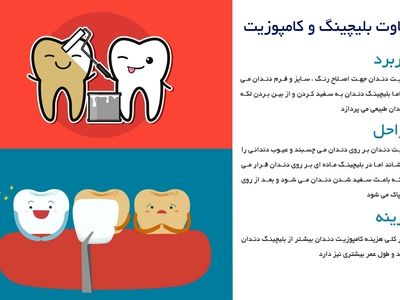تفاوت بلیچینگ و کامپوزیت در چیست ؟