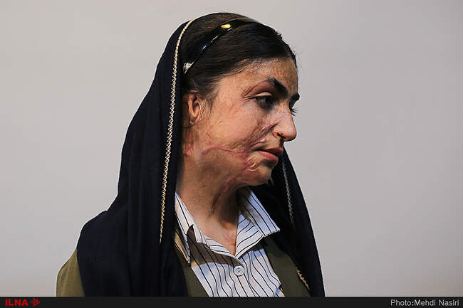 موج آرزوهای سوخته بر صورت دخترکان شین آبادی