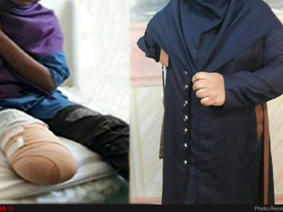 بعد از یکسال هنوز "دست مصنوعی متحرک" برایم نخریدند/دیگر کسی اسمی از "حادثه داراب" نمی‌برد