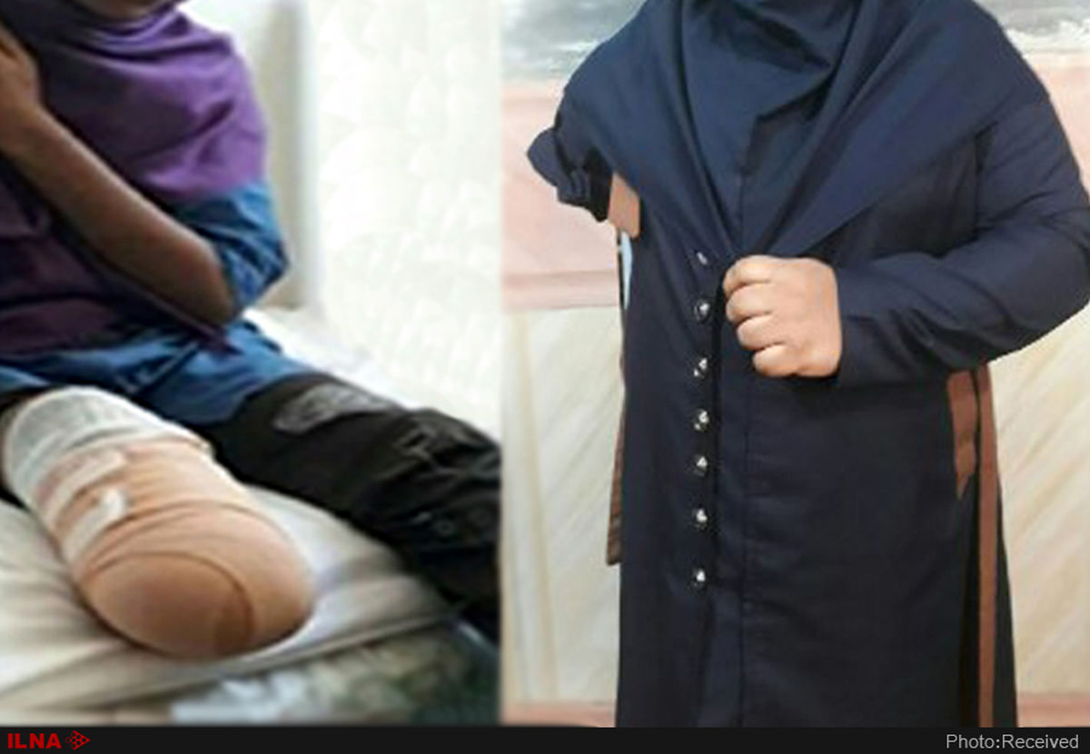 بعد از یکسال هنوز "دست مصنوعی متحرک" برایم نخریدند/دیگر کسی اسمی از "حادثه داراب" نمی‌برد