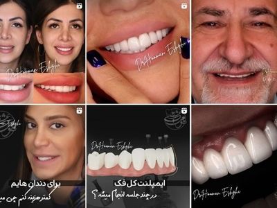 پیج اینستاگرام 5  بهترین "دکترهای کامپوزیت دندان در تهران"