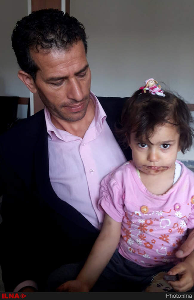 حمله 5سگ ولگرد به دختر بچه چهارساله در روستای یزن آباد از توابع شهرستان نمین استان اردبیل