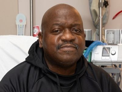 انقلابی تاریخی در حوزه پیوند کلیه حیوانات به انسان 