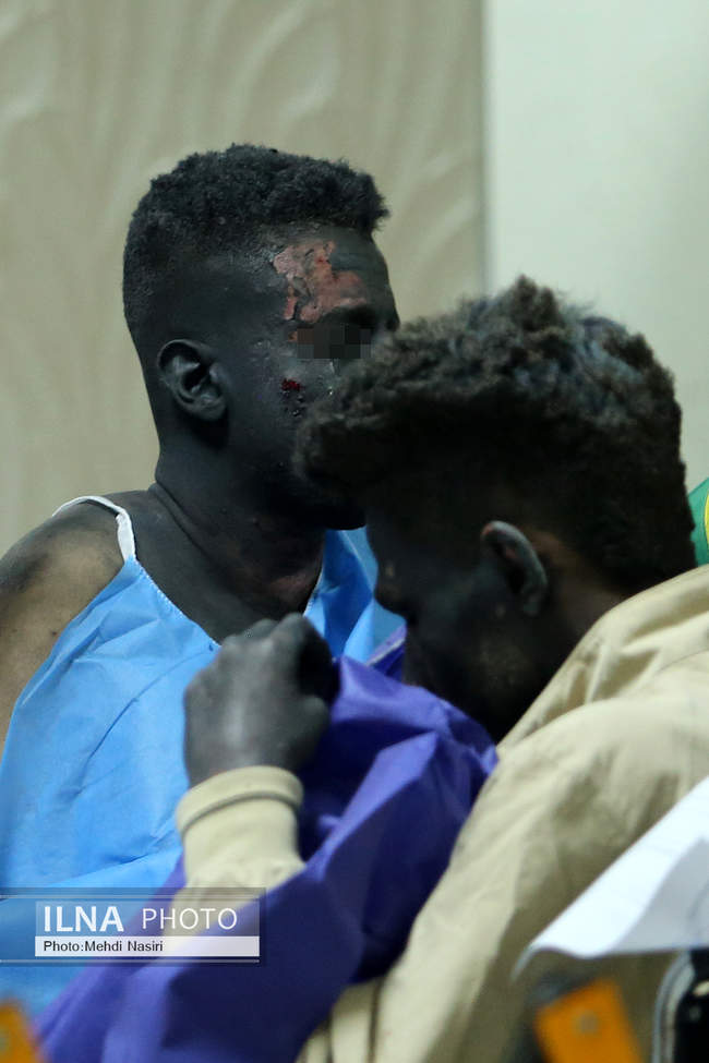 مصدومان چهارشنبه سوری بیمارستان سوانح سوختگی تهران