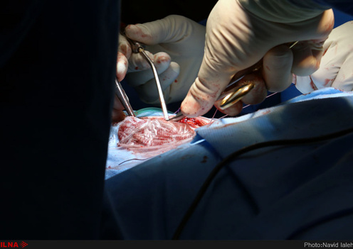 جراحی لامینکتومی توسط دکتر مهرداد اسماعیلی جراح مغز و اعصاب در بیمارستان مرکزی شیراز